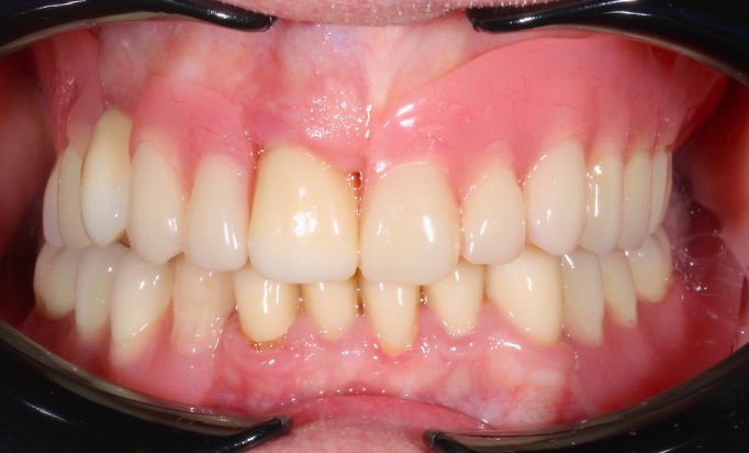 After -Gibside Dental