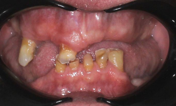 Before - Gibside Dental