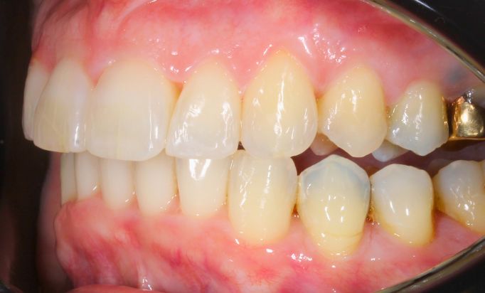 After -Gibside Dental