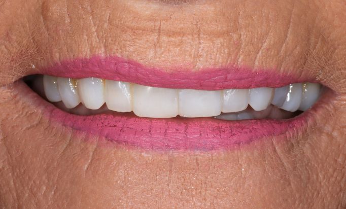 After -Gibside Dental