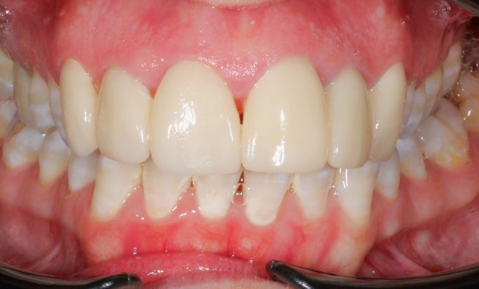 After -Gibside Dental